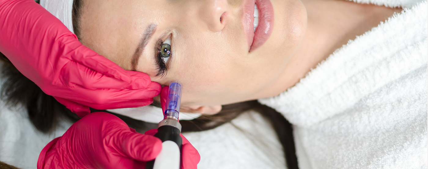 Microneedling