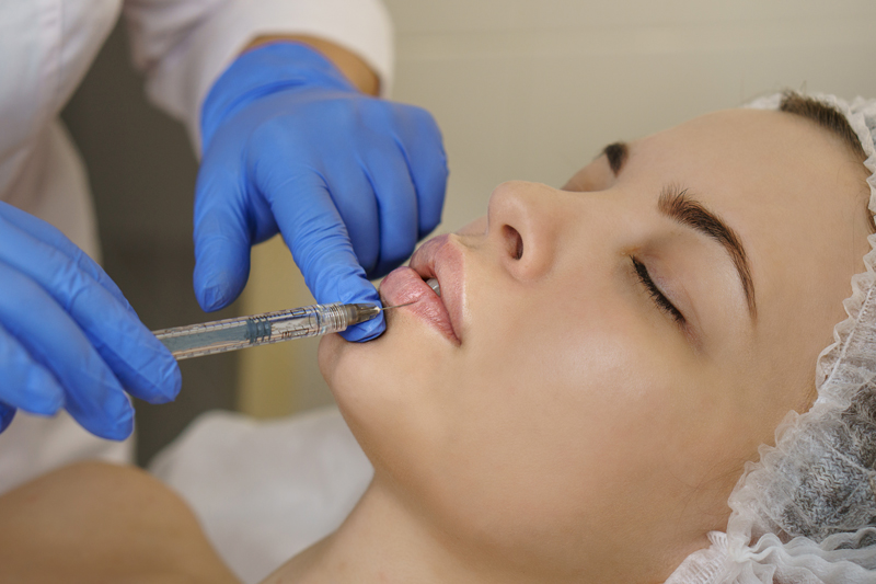 Hyaluron_Lippenvolumen_Mainz