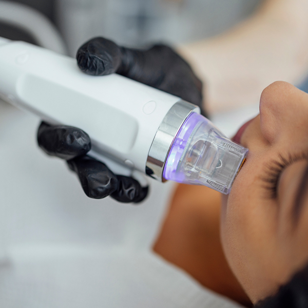 radiofrequenz_needling_2